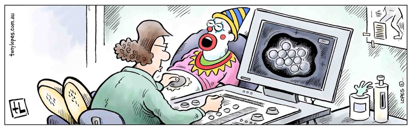 Clown X-ray